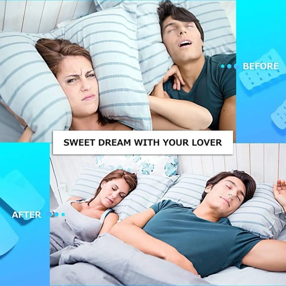 Silicone Anti-Snoring Nasal Dilator