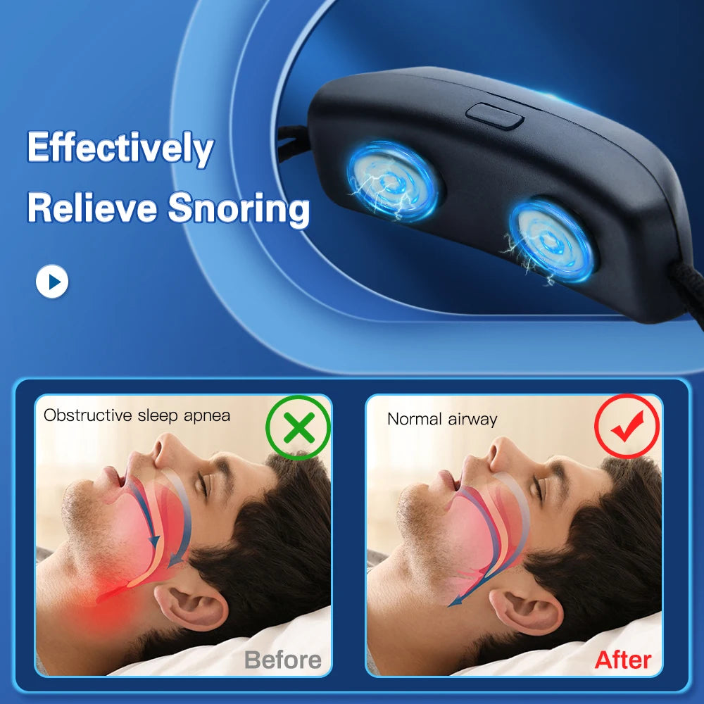 EMS Smart Anti-Snoring Device – USB Rechargeable Sleep Apnea Aid