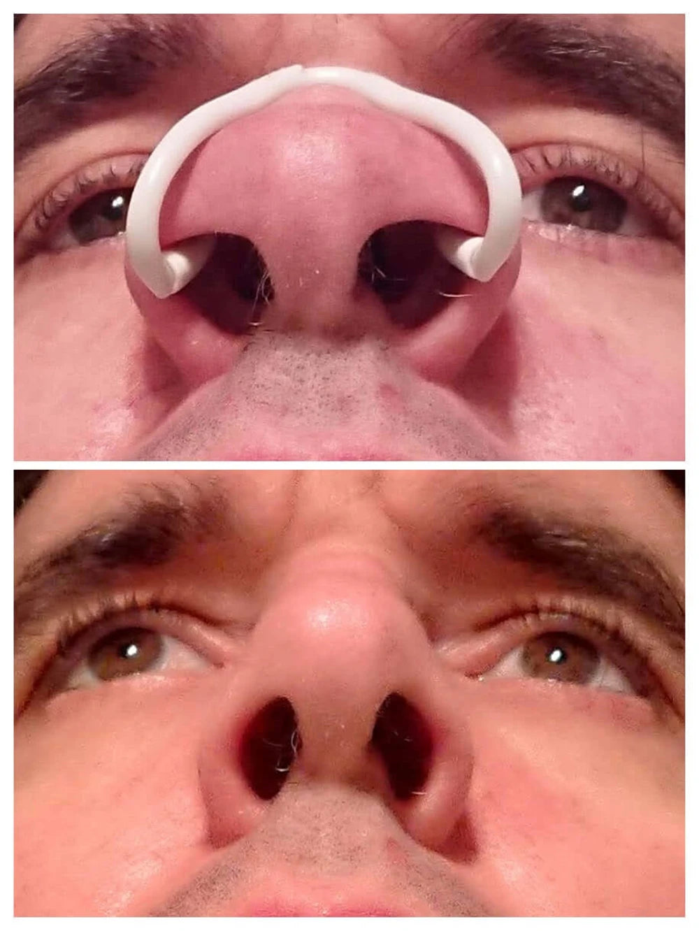 Silicone Nasal Dilator Anti-Snoring Nose Clip